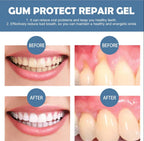 📢📢49% Off!!⏰ Teeth Whitening & Repair Gel 🦷