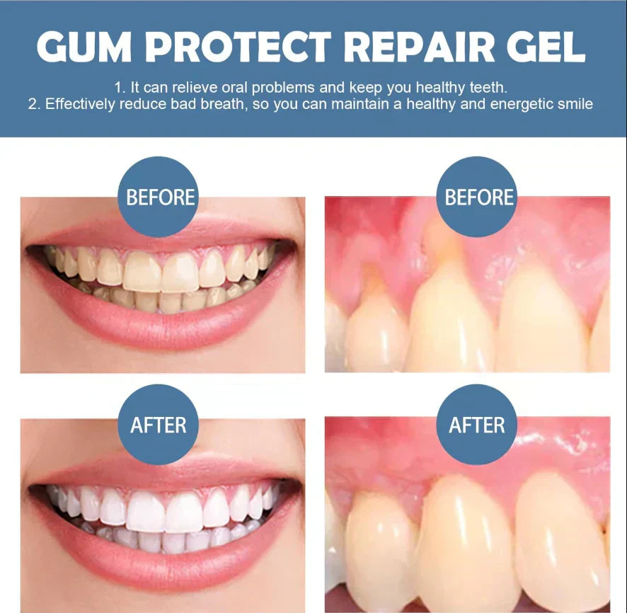 📢📢49% Off!!⏰ Teeth Whitening & Repair Gel 🦷