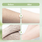 Gentle and Non-Irritating Hair Removal Cream|Limited-time offer🎁