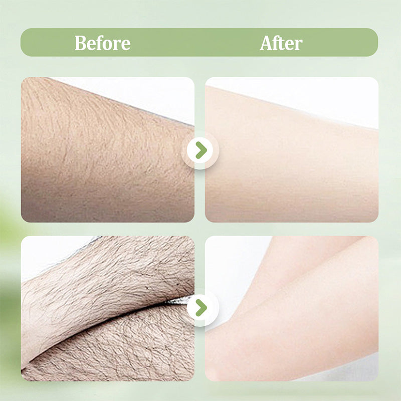 Gentle and Non-Irritating Hair Removal Cream|Limited-time offer🎁